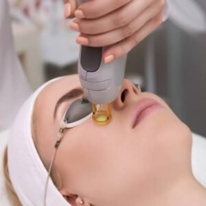 fractional-laser